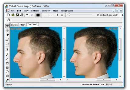 Free Virtual Plastic Surgery Software